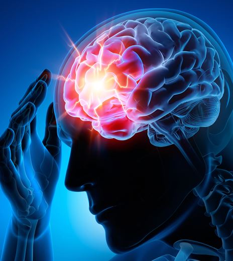 VERANSTALTUNG_Vortrag Migräne.jpg